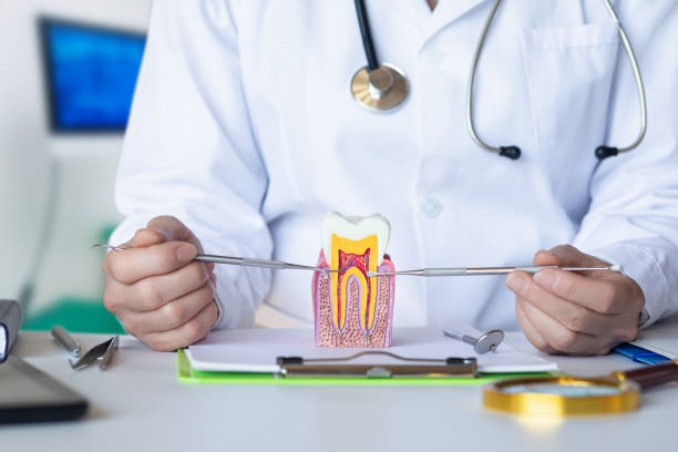 Best Broken or Chipped Tooth Repair in Yorba Linda, CA